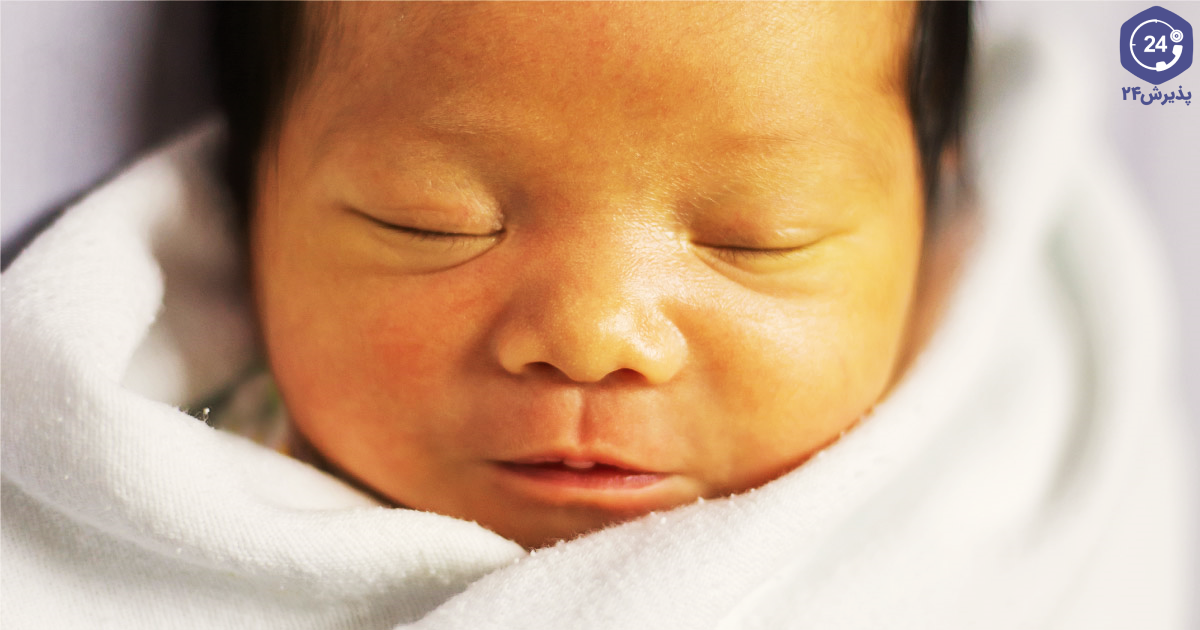 تشخیص به موقع کرن ایکتروس نوزاد بسیار مهم است.