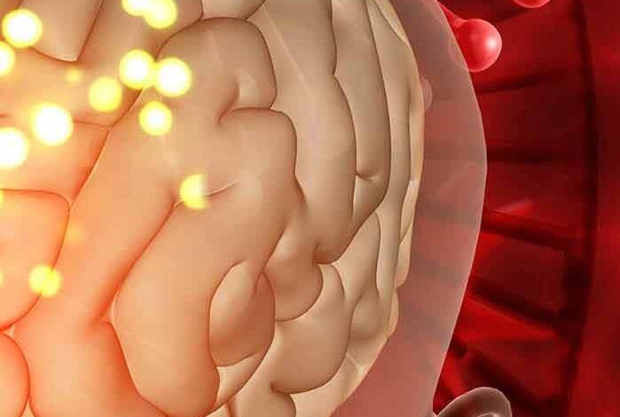 آپوپلکسی هیپوفیز