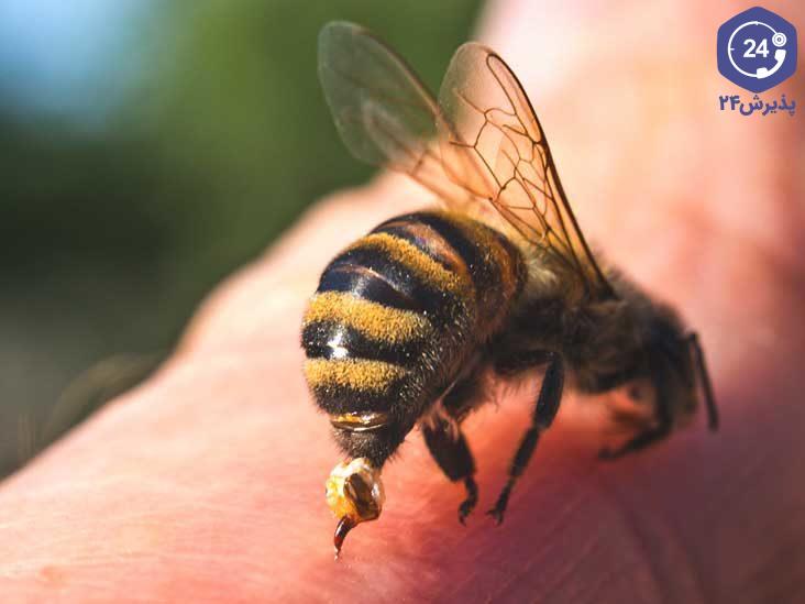 درمان نیش زنبور در خانه