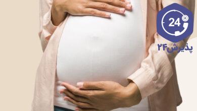 عمل بینی در بارداری و شیردهی