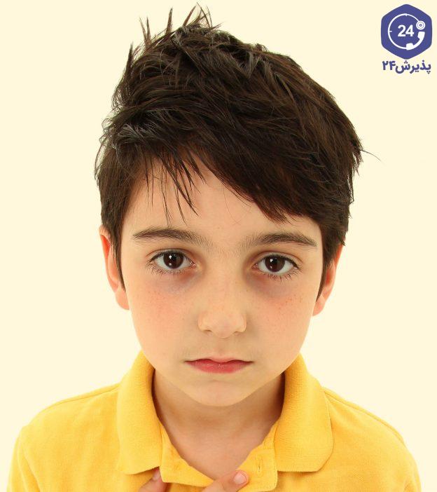 H:\نویسش\How-To-Get-Rid-Of-Dark-Circles-Under-Eyes-In-Kids1-624x702.jpg