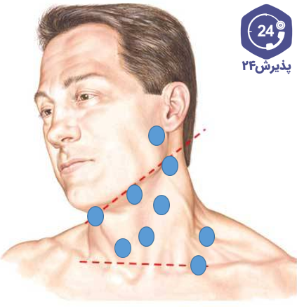 https://www.thomashosurgery.com/wp-content/uploads/2020/09/neck-lump-illustration-e1601209585797.png