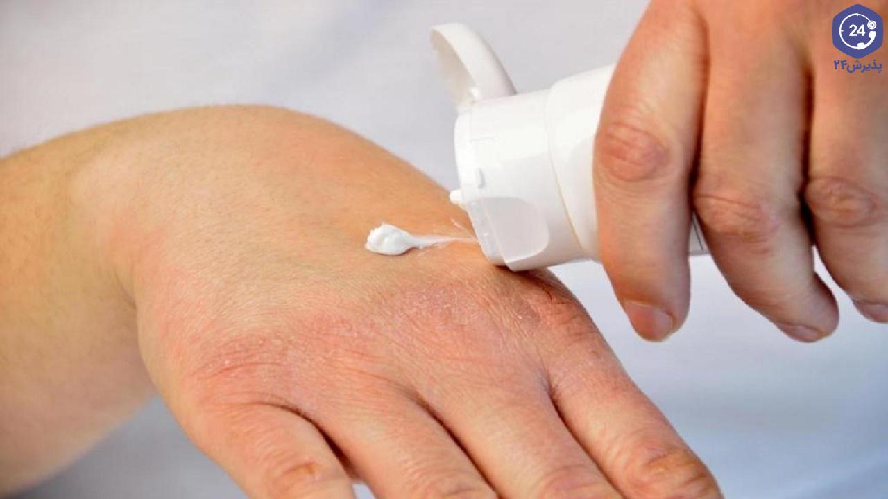 پماد برای خشکی پوست دست