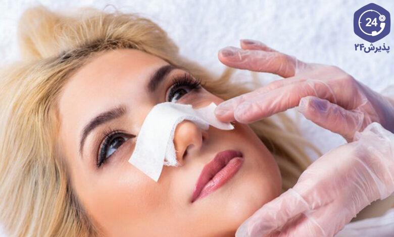 گچ بینی یا اسپلینت