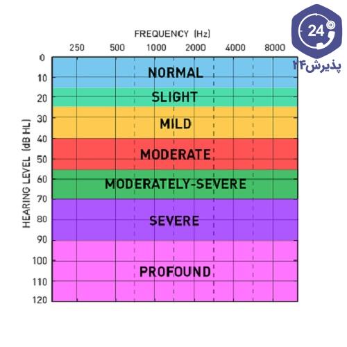تست شنوایی سنجی نوار گوش