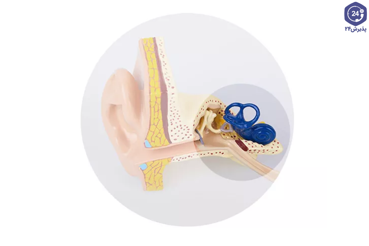 تشخیص کم شنوایی حسی عصبی