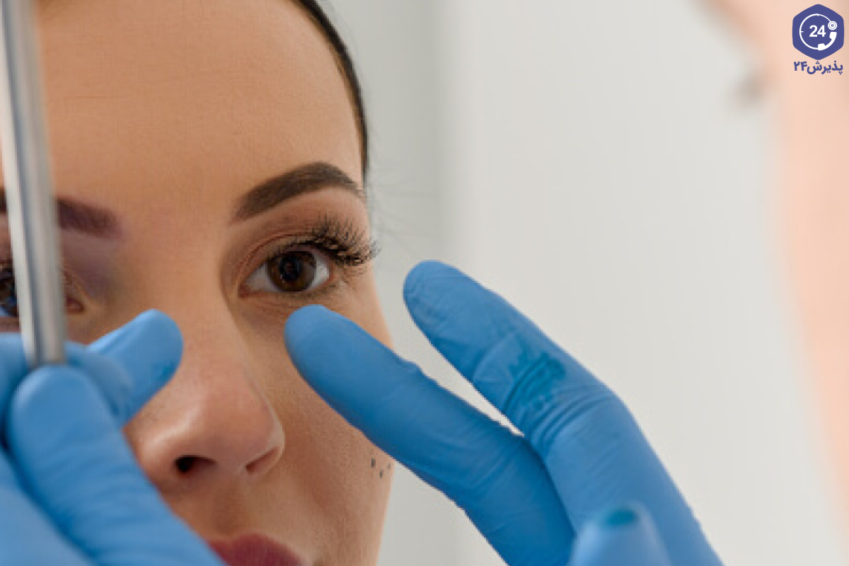 نقش پوست در جراحی بینی
