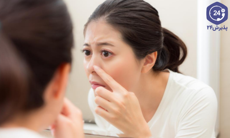 چرب شدن پوست بینی بعد از جراحی