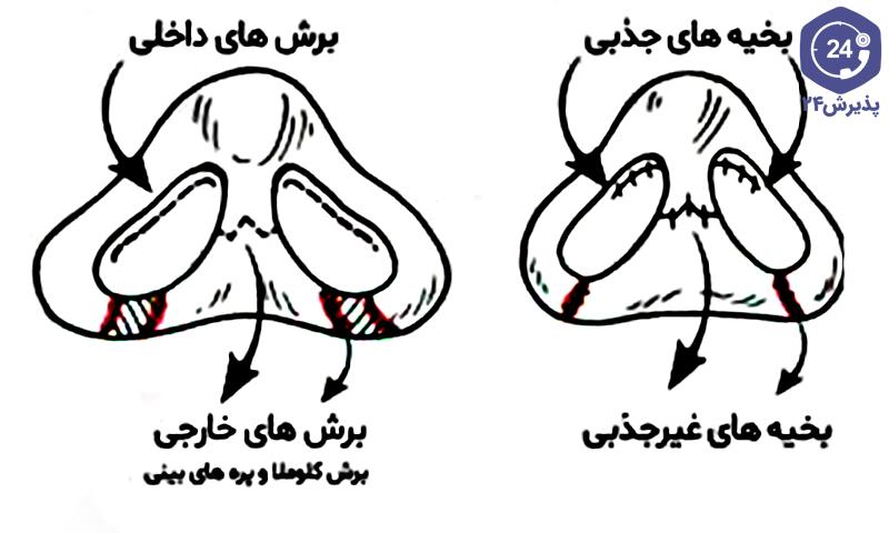 عکس بخیه داخل بینی