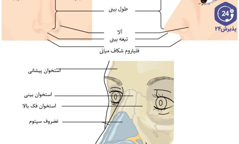 پل بینی