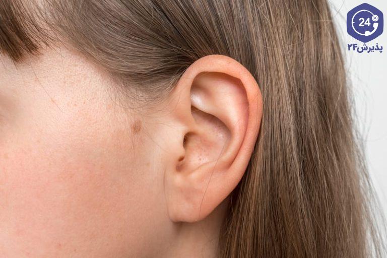 راه‌های پیشگیری از کشیدگی و پارگی سوراخ لاله گوش با گوشواره