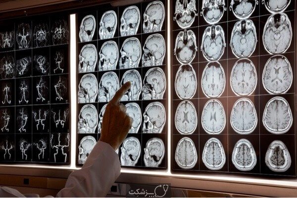 عکس متخصص-مغز-و-اعصاب-3